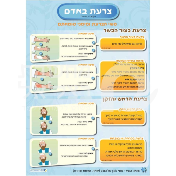 הצערת והמצורע כרזות